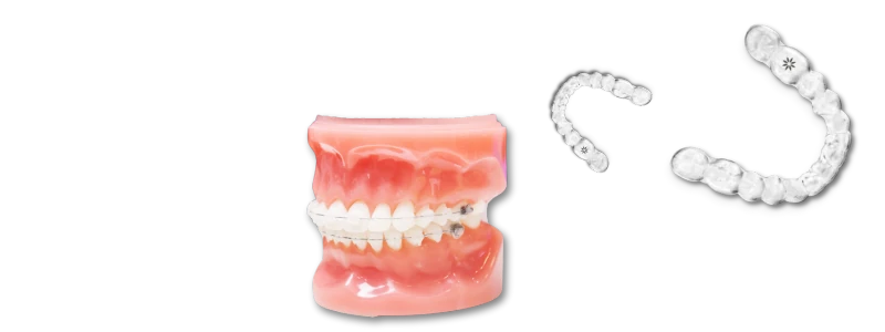 3D Teeth Scanner