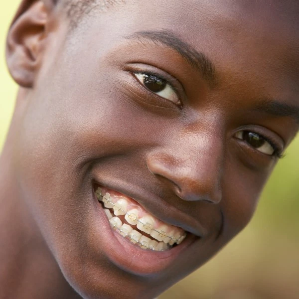 Gold Braces Ridgeland Gold Braces Ridgeland